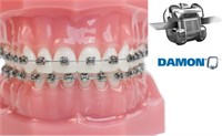 Набор брекетов Damon Q ( набор 10 шт, верхняя челюсть, самолигирующая пассивная система, паз .022) Damon Q верх